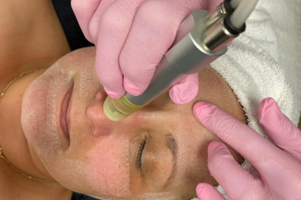 crystal-microdermabrasion